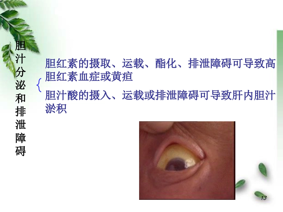 肝功能不全病理学_第13页