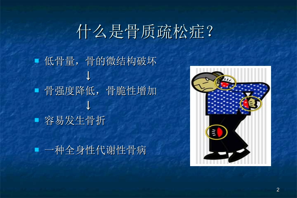 骨科-骨质疏松症ppt_第2页