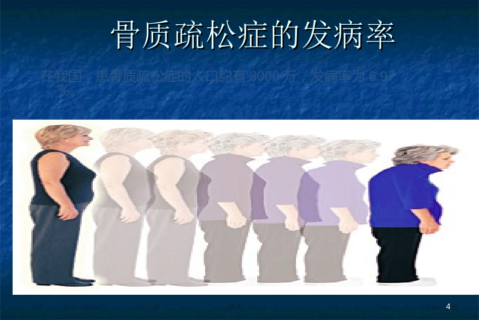 骨科-骨质疏松症ppt_第4页