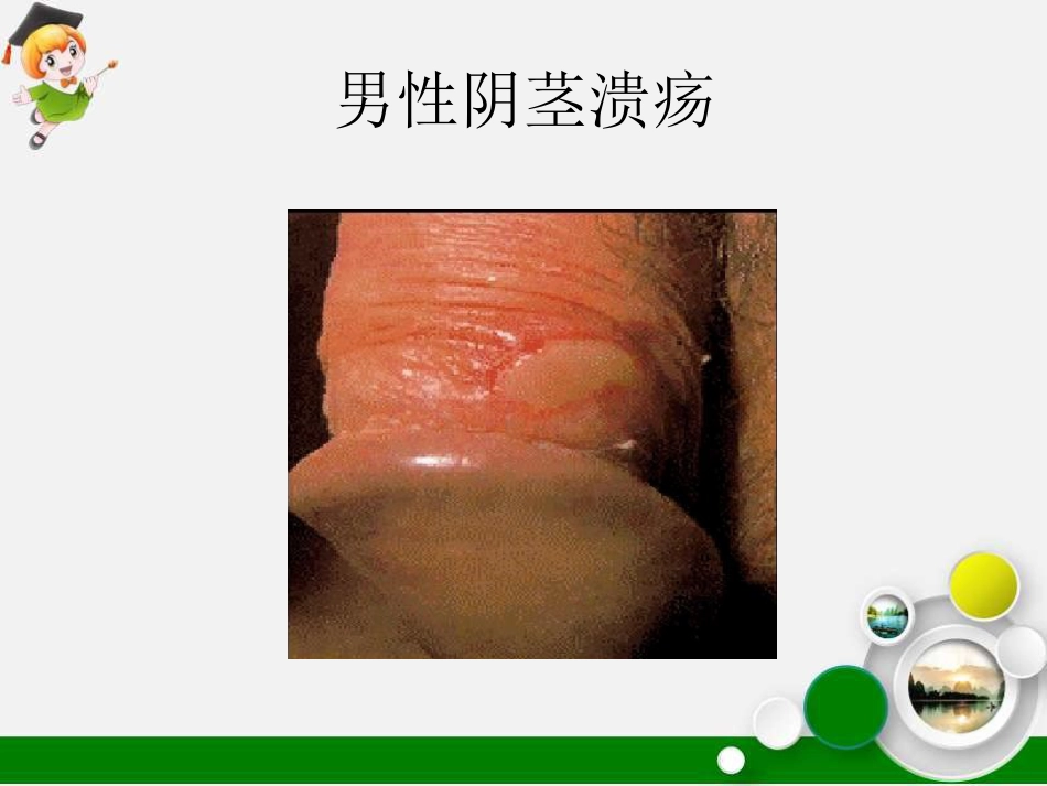 白塞病临床表现及治疗_第13页