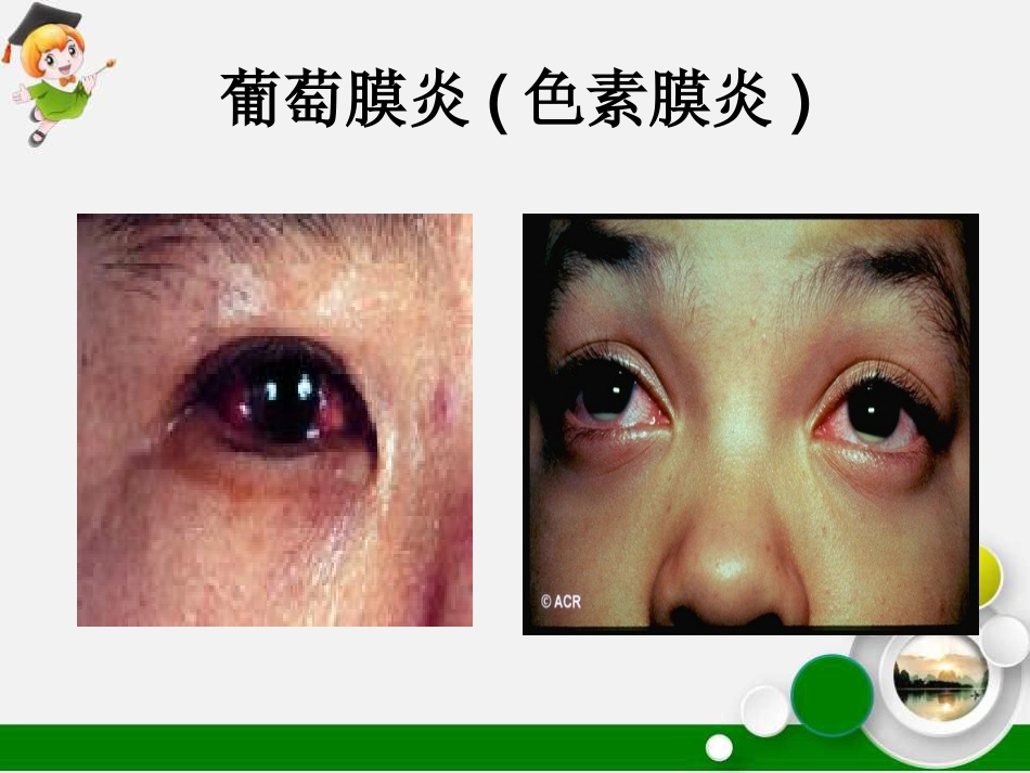 白塞病临床表现及治疗_第15页