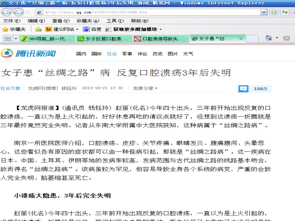 白塞病临床表现及治疗_第4页