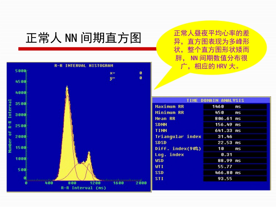 HRV分析的临床应用讲解_第13页