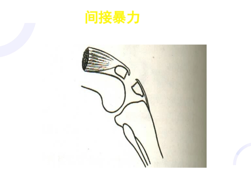 骨科-骨折概论（修改）_第7页