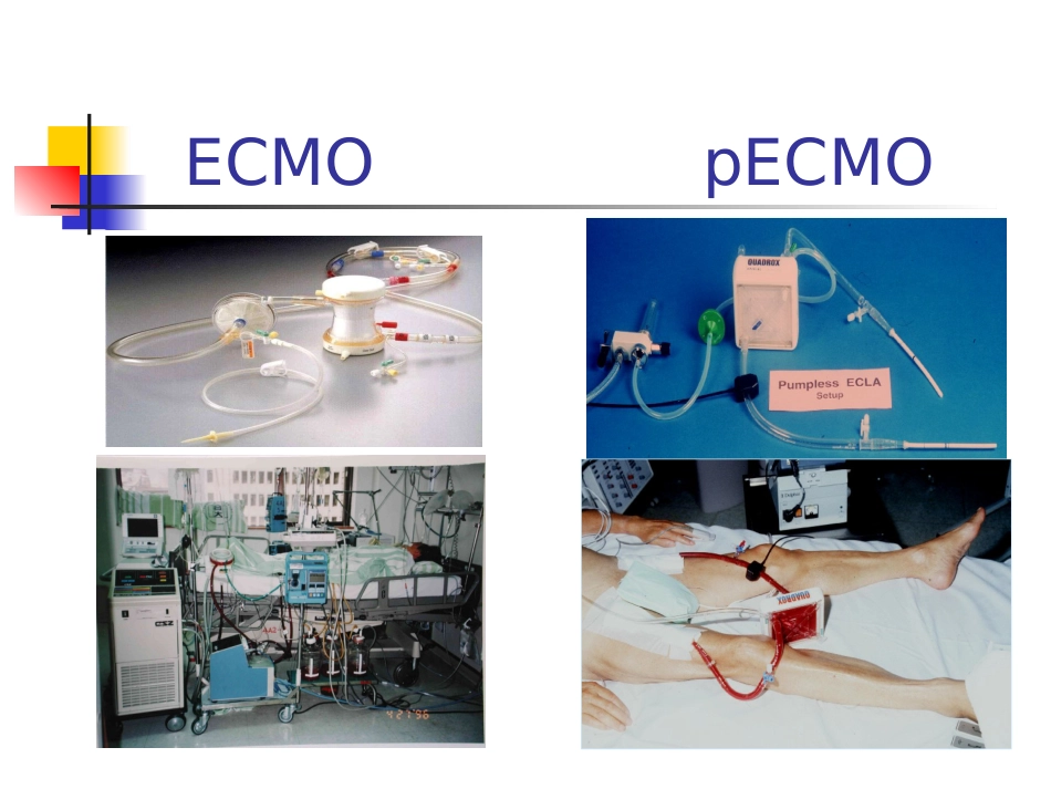 ECMO的临床应用_第13页