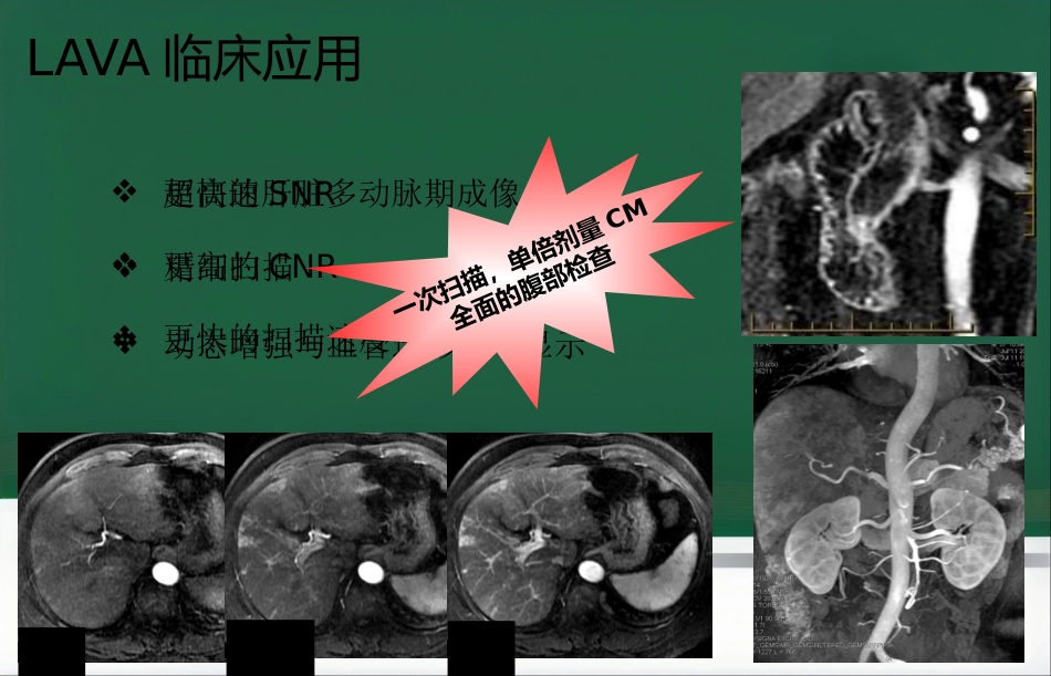 LAVA原理和临床应用ppt_第10页