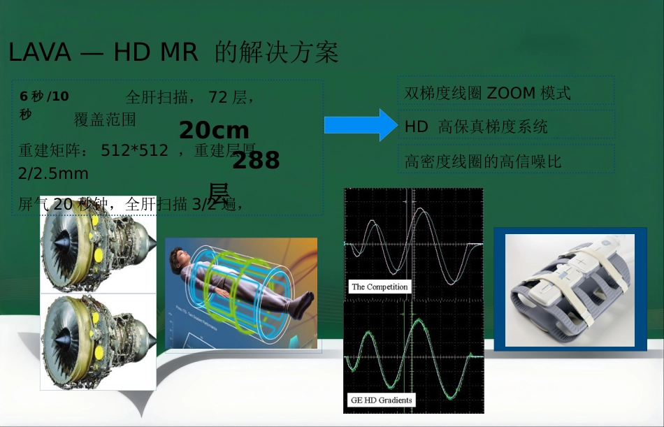 LAVA原理和临床应用ppt_第12页