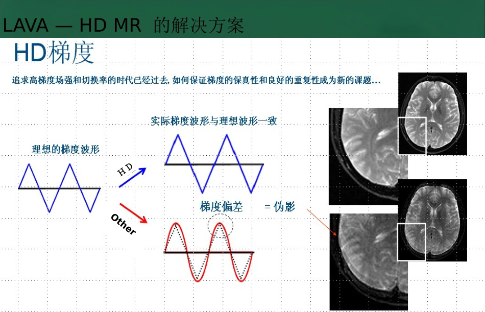 LAVA原理和临床应用ppt_第15页