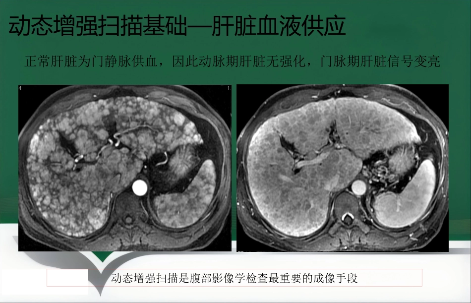 LAVA原理和临床应用ppt_第4页