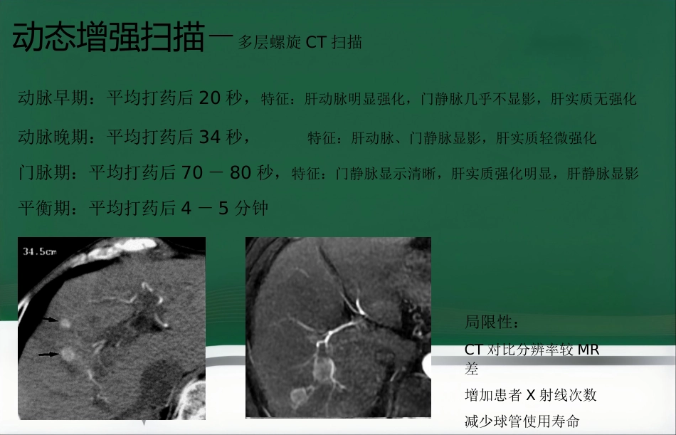 LAVA原理和临床应用ppt_第6页