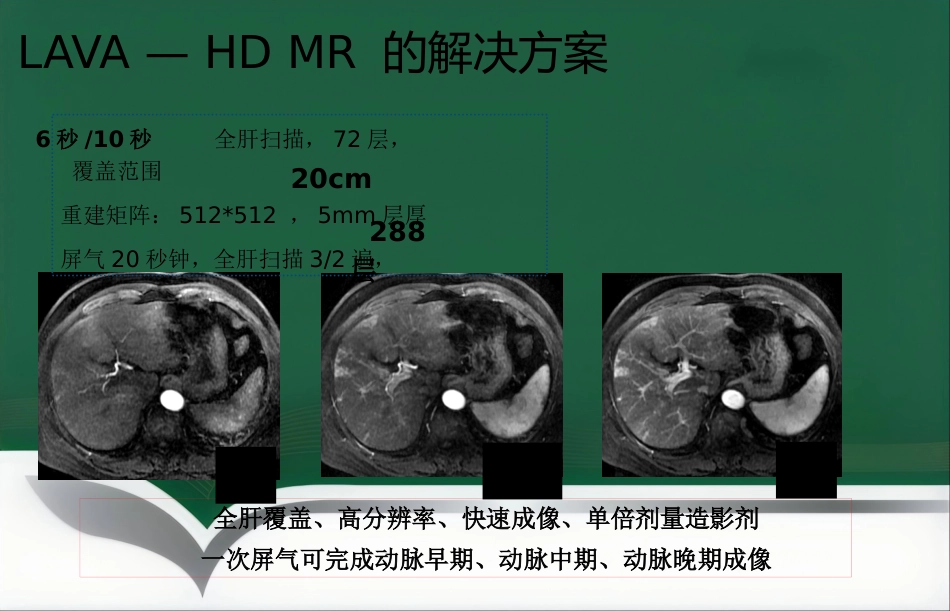 LAVA原理和临床应用ppt_第9页