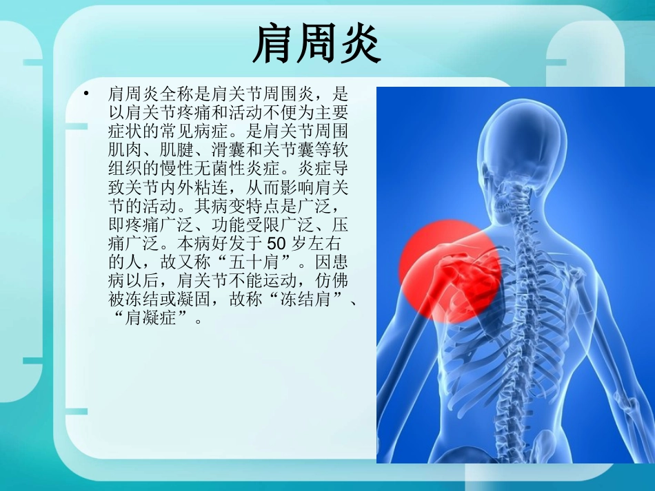骨科-肩周炎_第1页