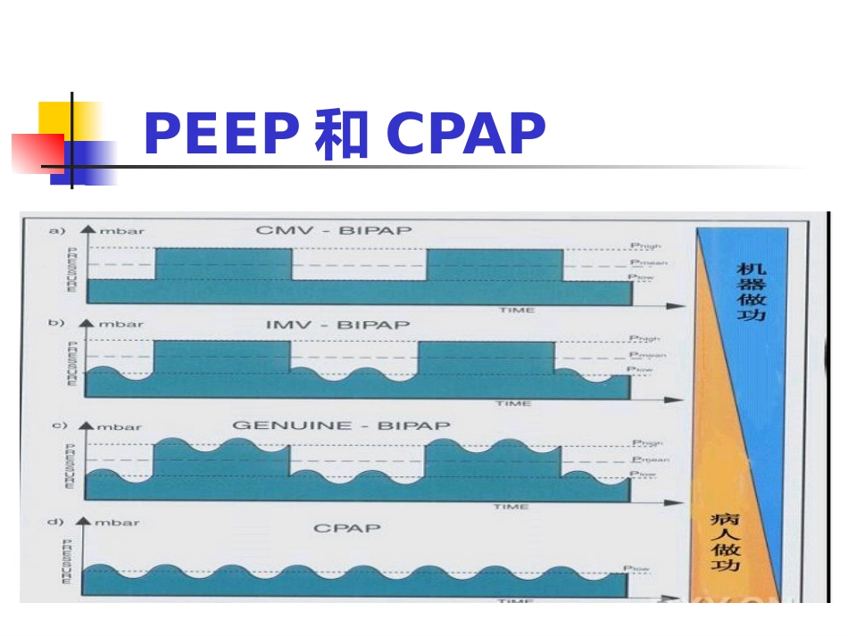 PEEP及其临床应用_第8页