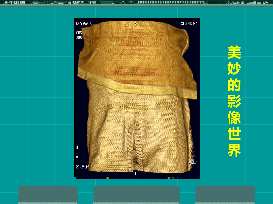 MRI临床应用_第10页