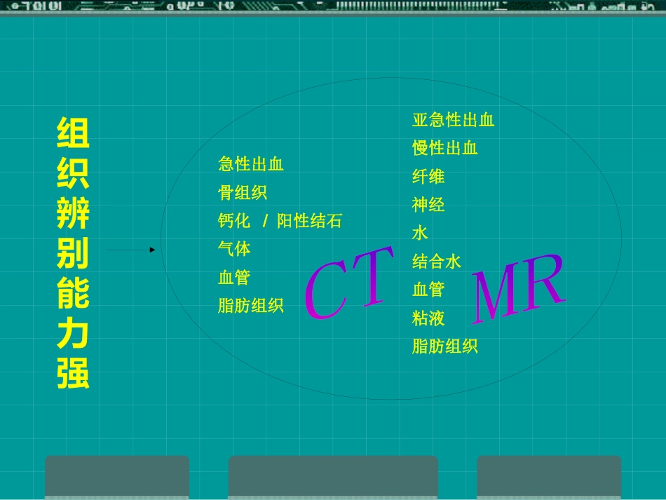 MRI临床应用_第13页