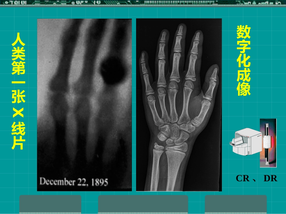 MRI临床应用_第2页