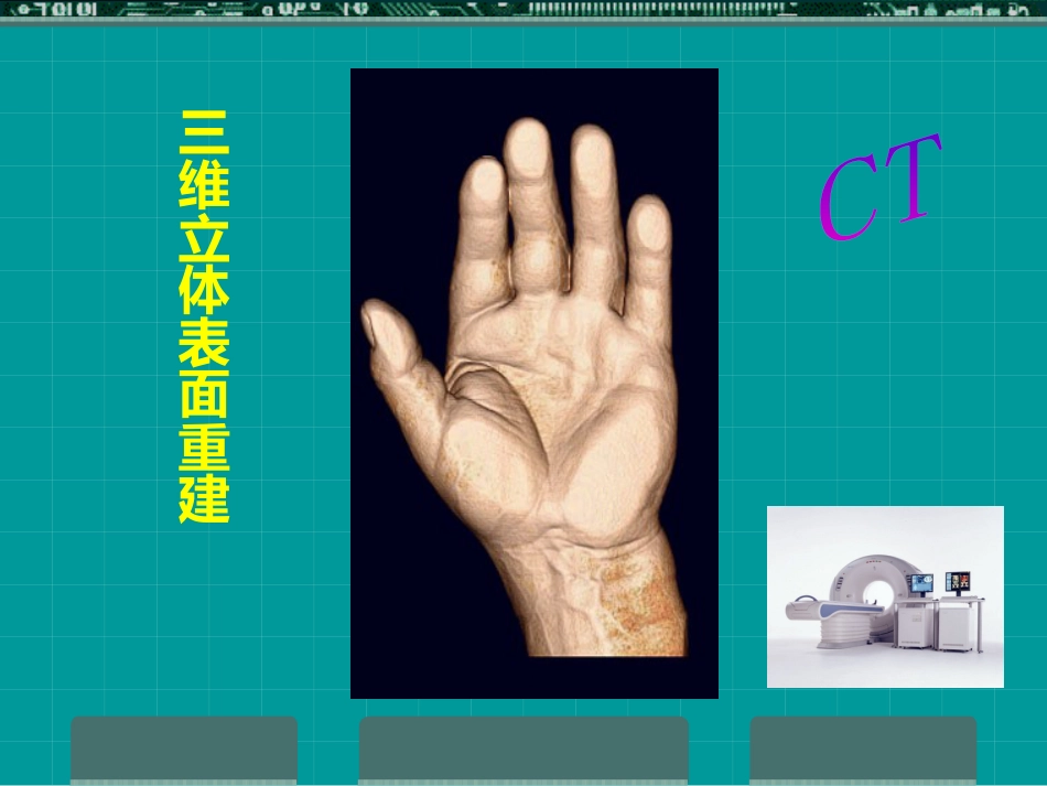 MRI临床应用_第3页