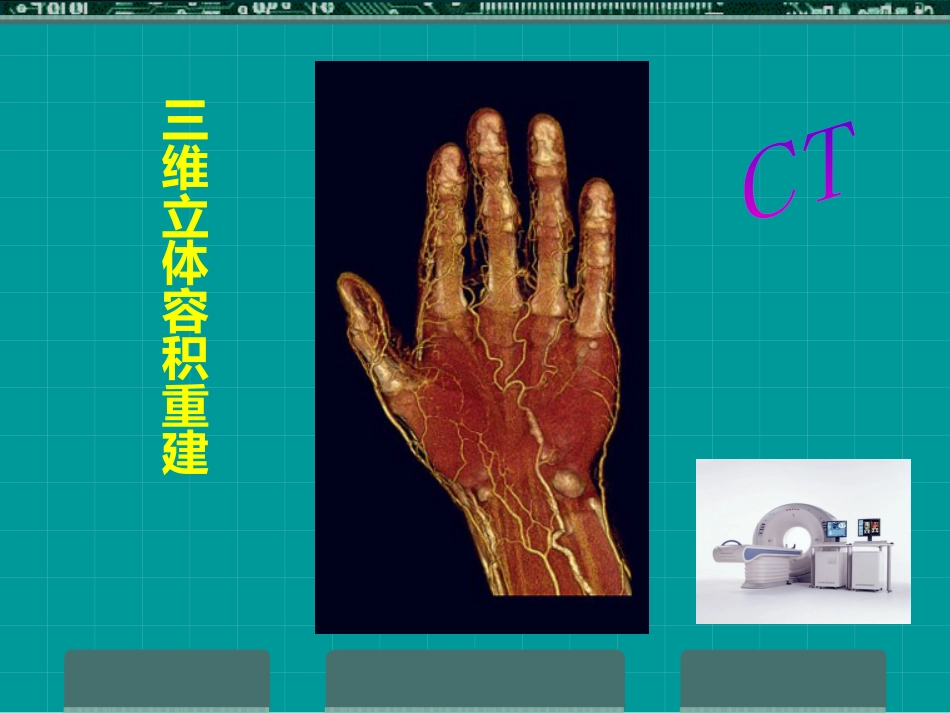 MRI临床应用_第4页