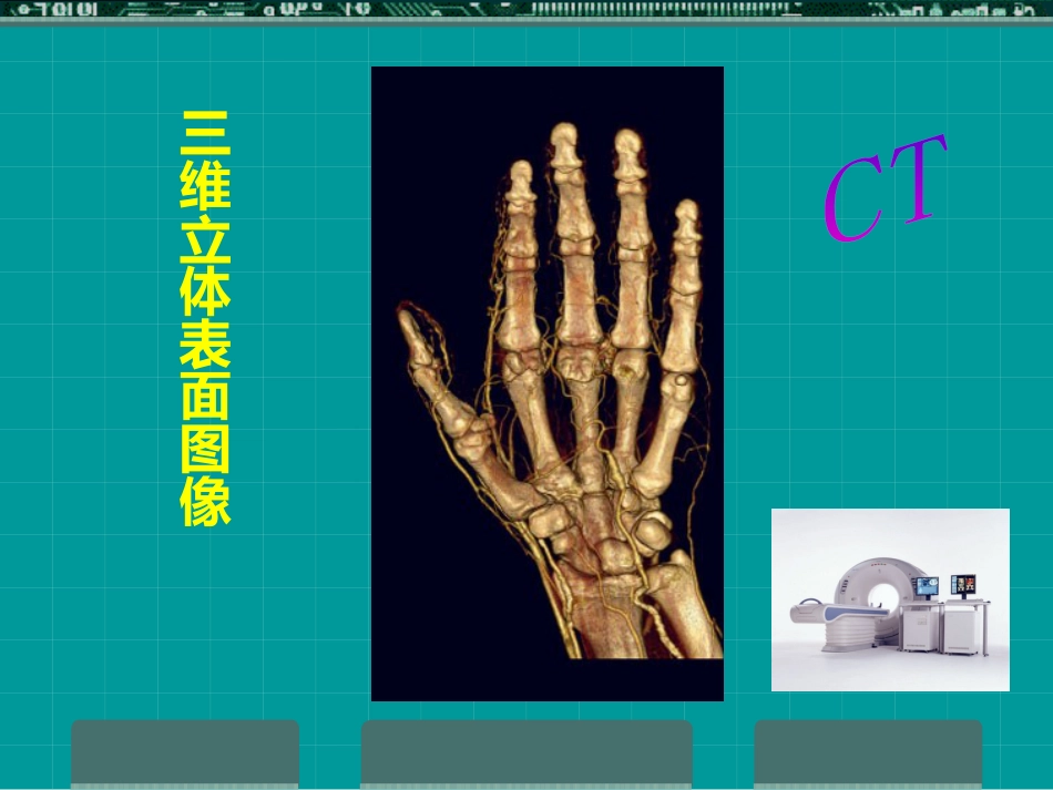 MRI临床应用_第5页