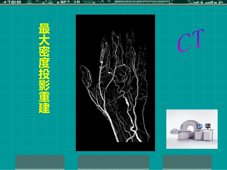 MRI临床应用_第6页