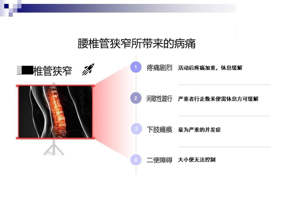 大通道椎间孔镜在老年腰椎管狭窄症患者中的应用和优势_第3页