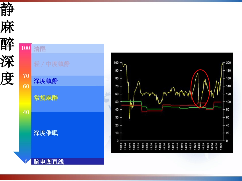 BIS监测的临床意义及新进展 PPT_第12页