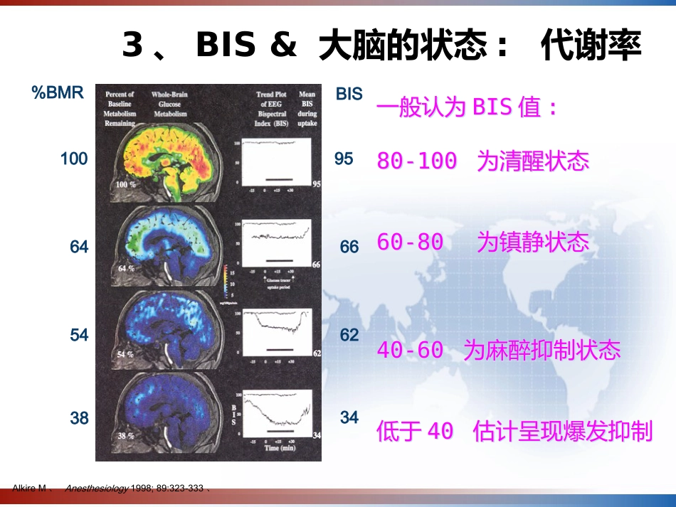 BIS监测的临床意义及新进展 PPT_第13页