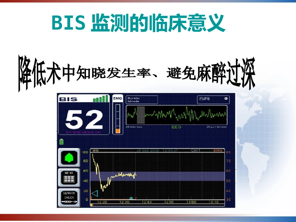 BIS监测的临床意义及新进展 PPT_第15页
