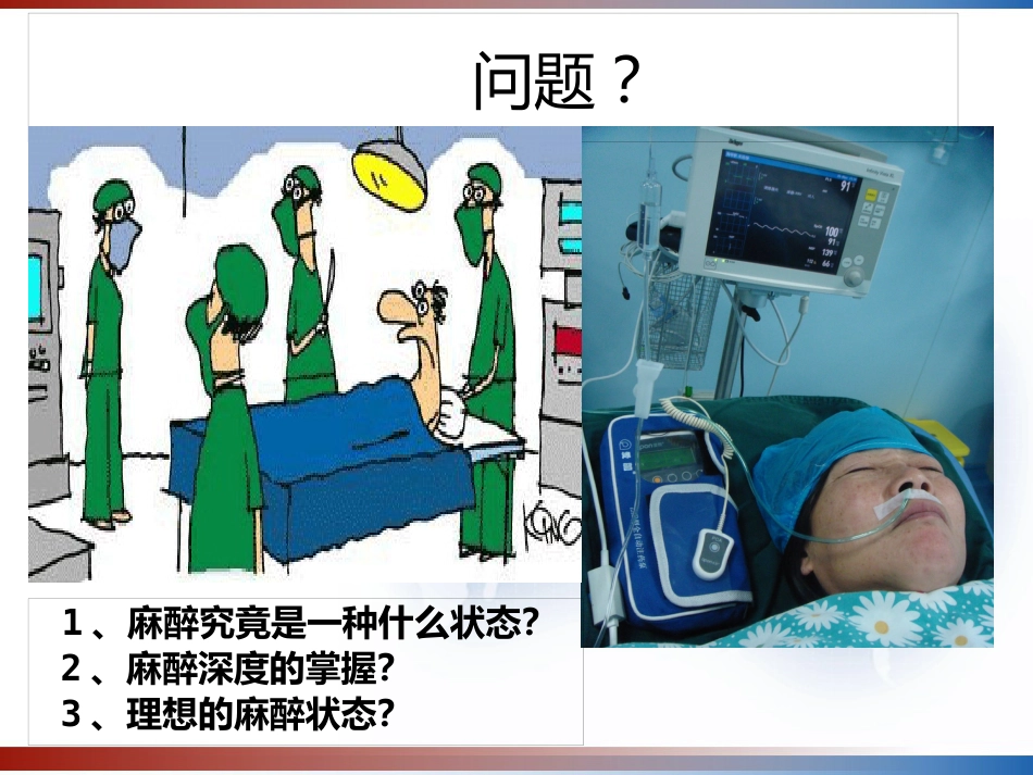 BIS监测的临床意义及新进展 PPT_第3页