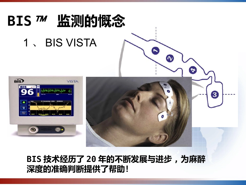 BIS监测的临床意义及新进展 PPT_第9页