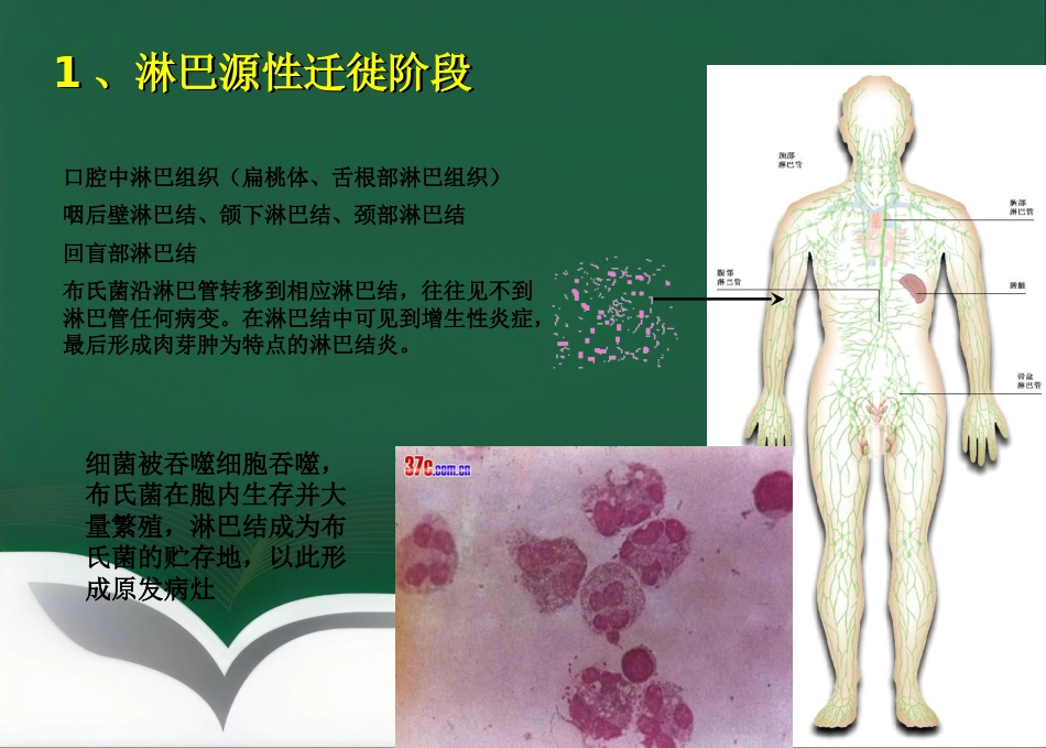 布鲁氏菌病临床诊治优_第7页