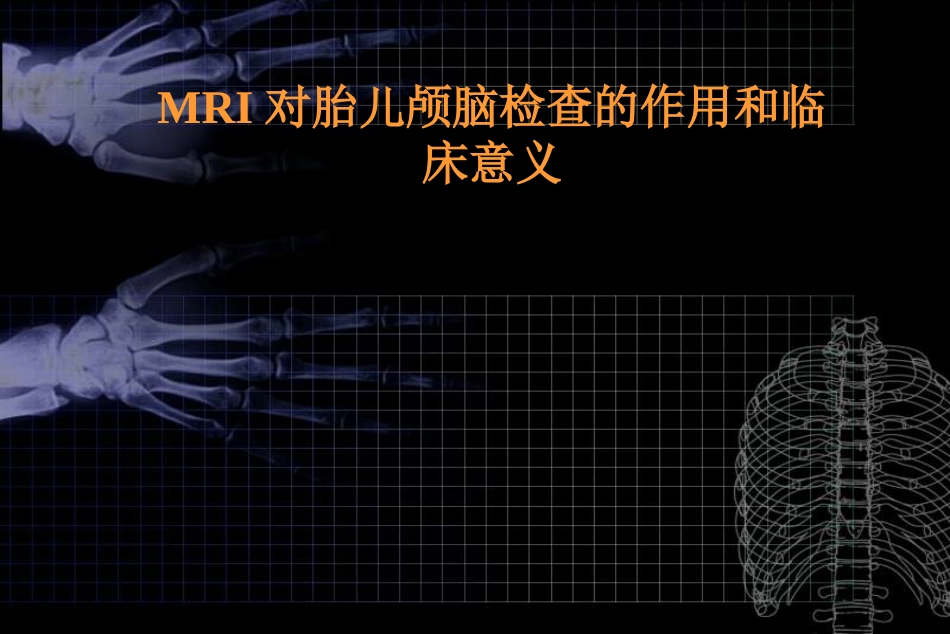 MRI对胎儿颅脑检查的作用和临床意义ppt课件_第1页