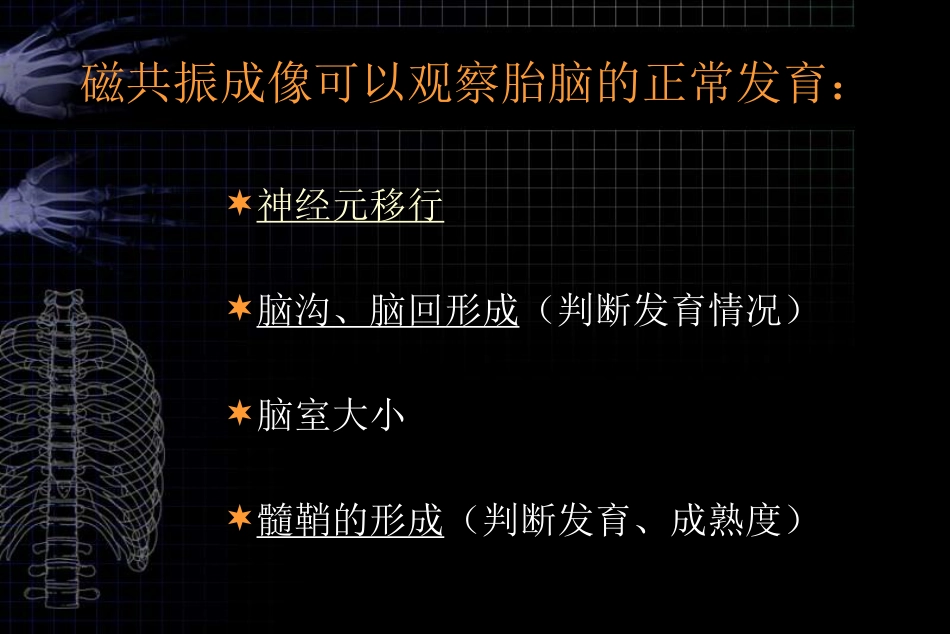 MRI对胎儿颅脑检查的作用和临床意义ppt课件_第15页