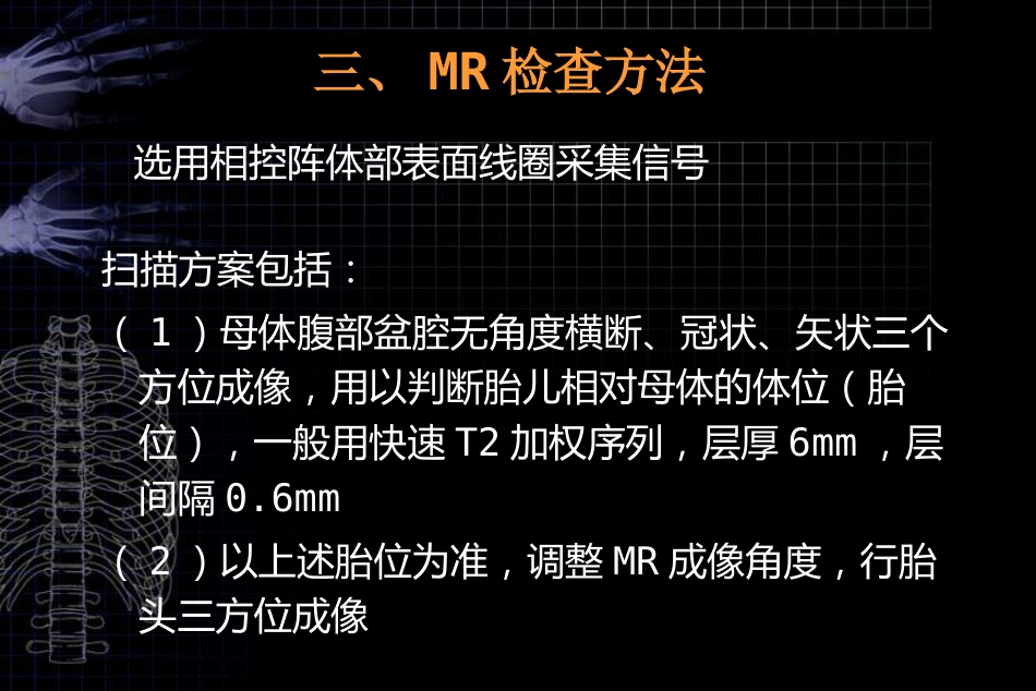 MRI对胎儿颅脑检查的作用和临床意义ppt课件_第7页