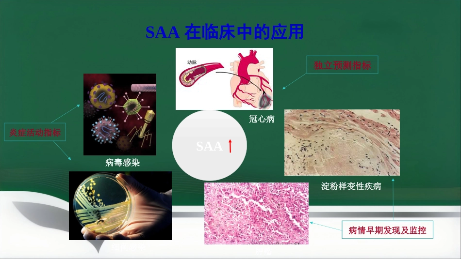 SAA联合CRP的临床诊断意义PPT讲稿_第13页