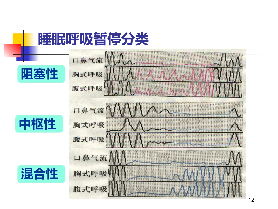 老年人睡眠障碍_第12页
