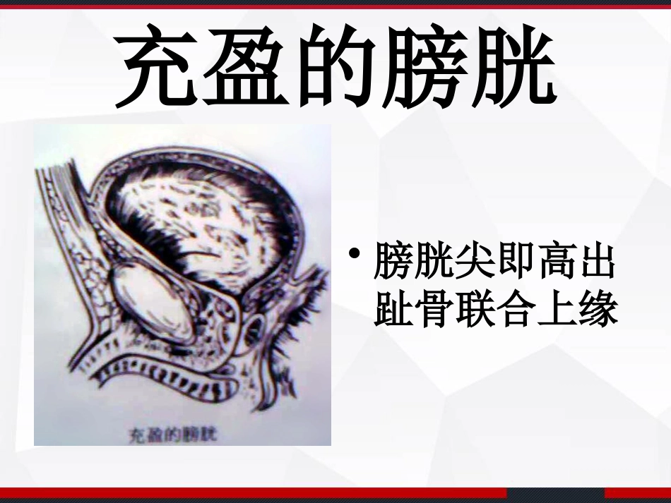 膀胱解剖及临床 PPT_第11页