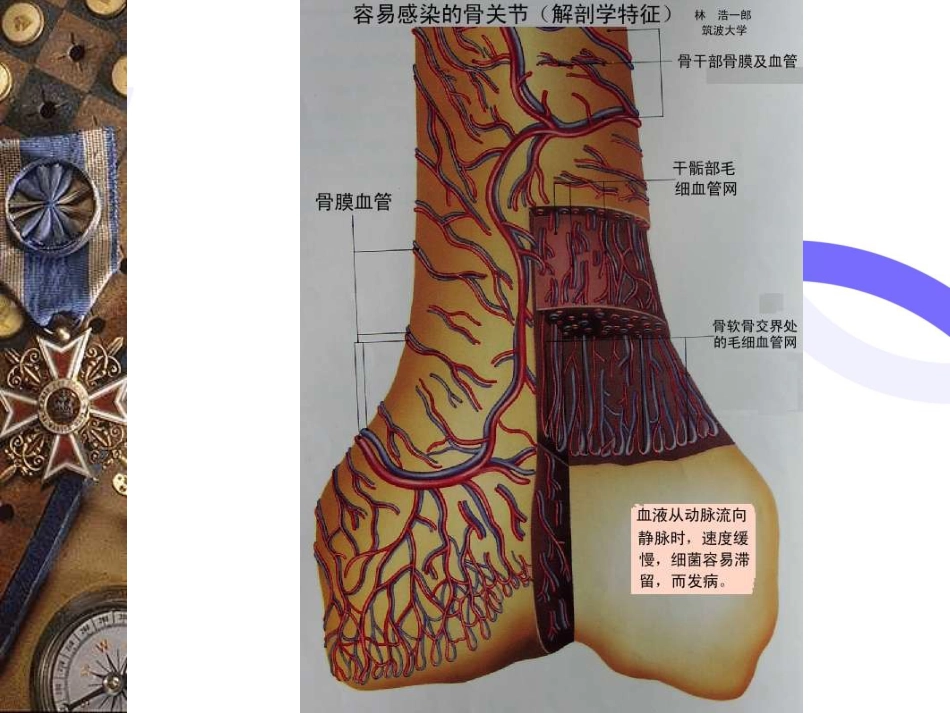 骨科-骨与关节感染_第5页