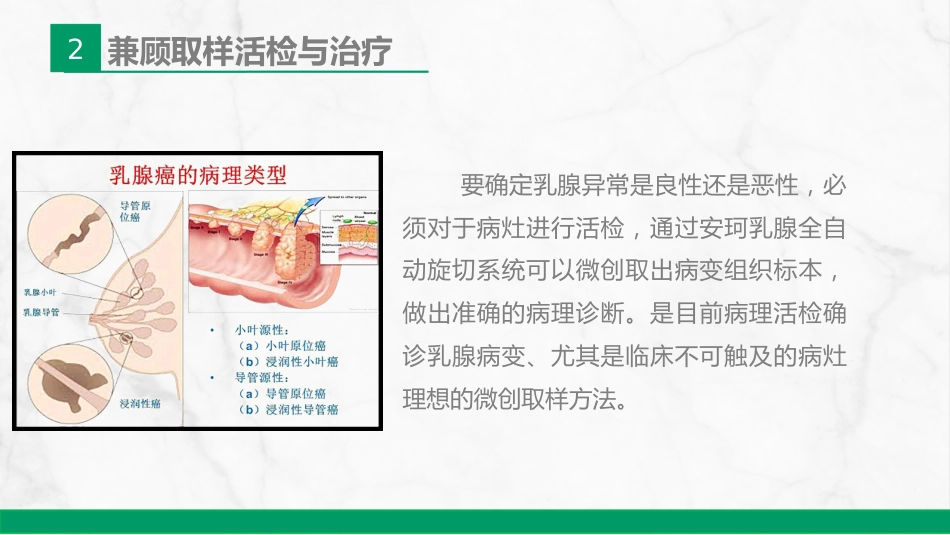 安珂乳腺旋切系统的临床应用_第14页