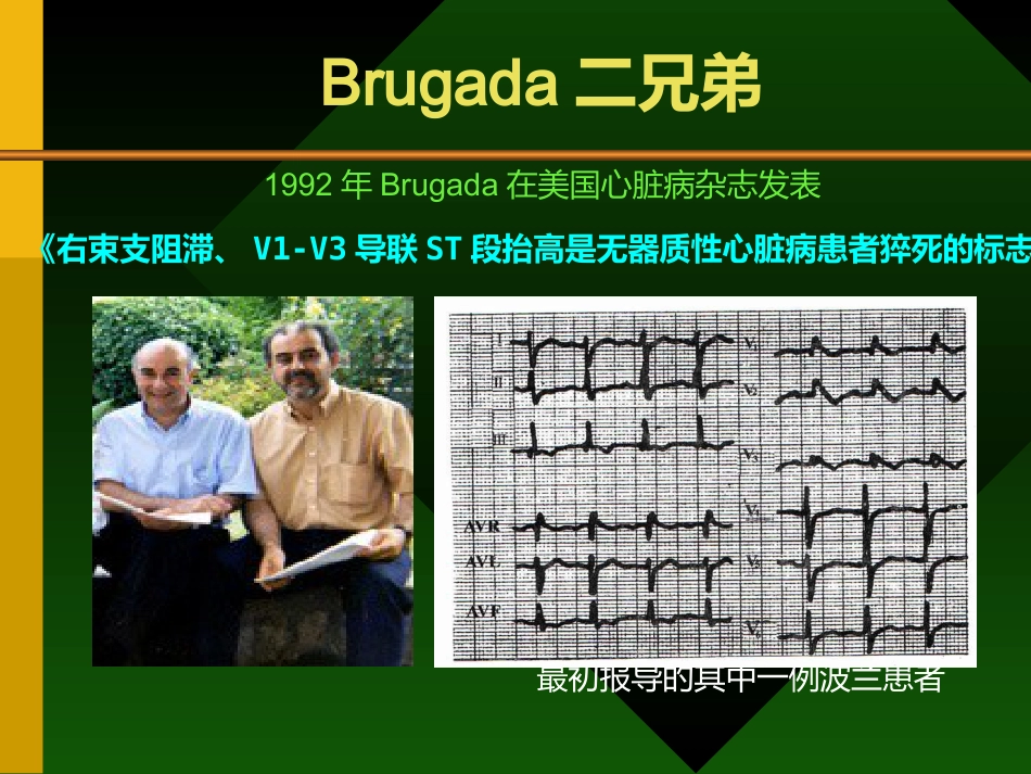 Brugada综合症的认识及其临床进展_第3页