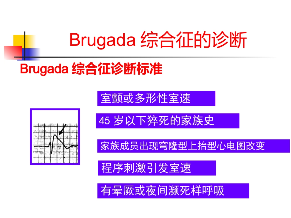 Brugada综合征的临床诊断_第11页