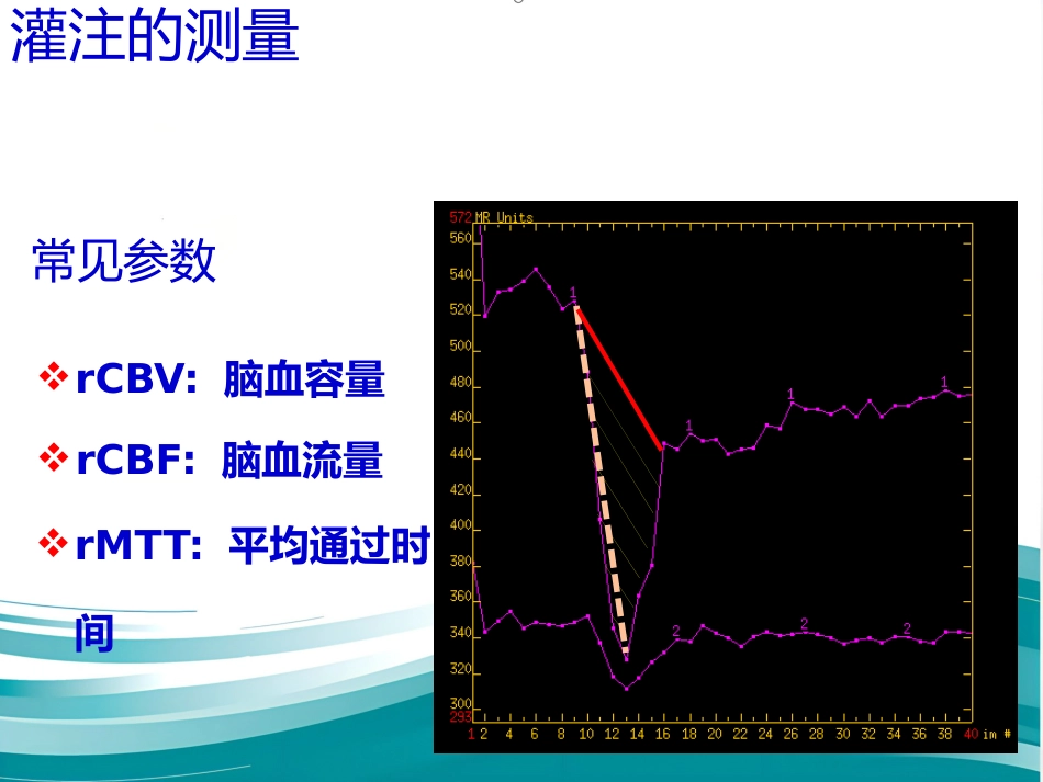PWI原理及临床应用_第13页