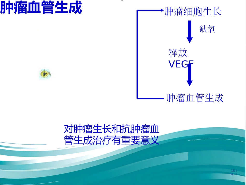 PWI原理及临床应用_第15页