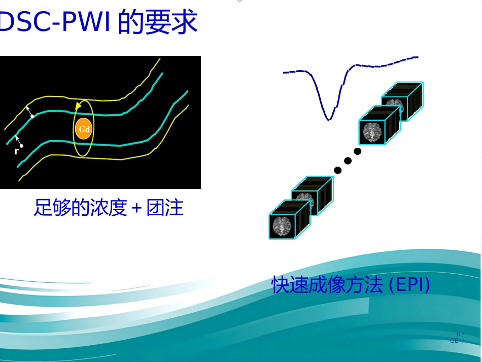 PWI原理及临床应用_第6页