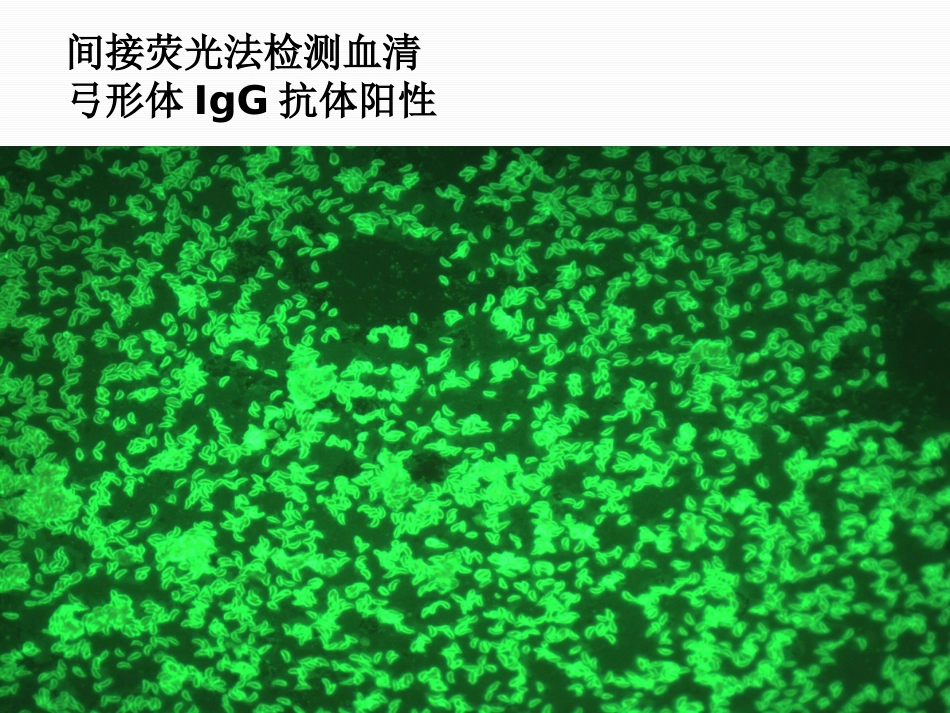 TORCH的检测及其临床意义_第13页