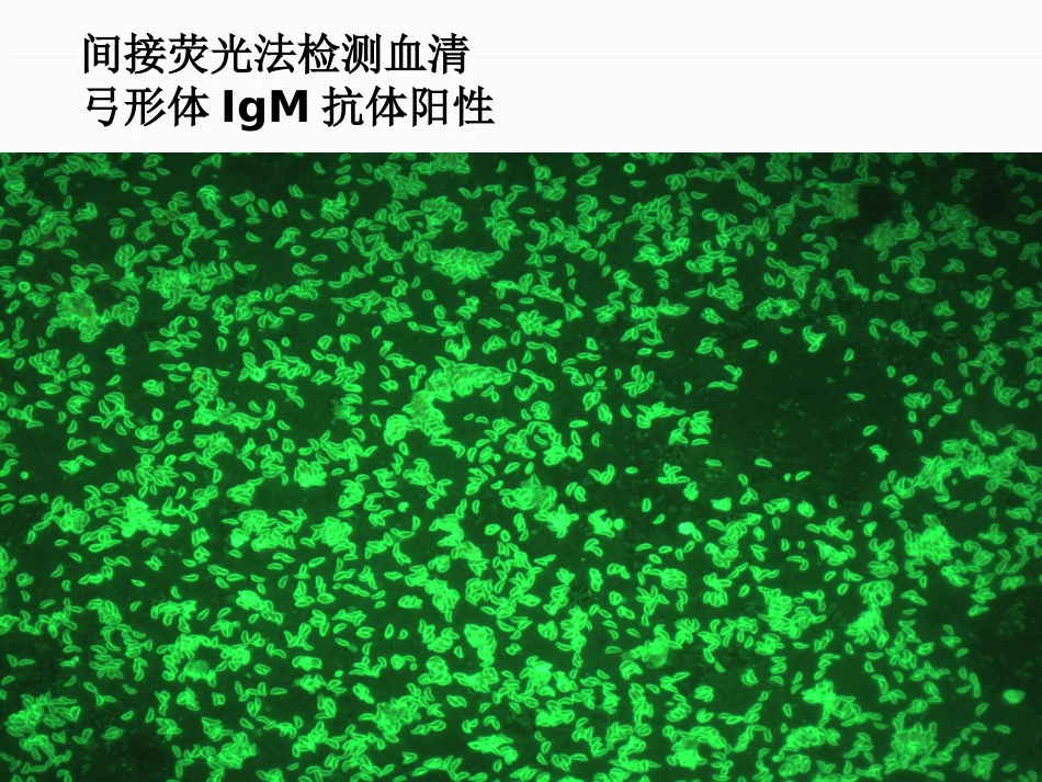 TORCH的检测及其临床意义_第14页