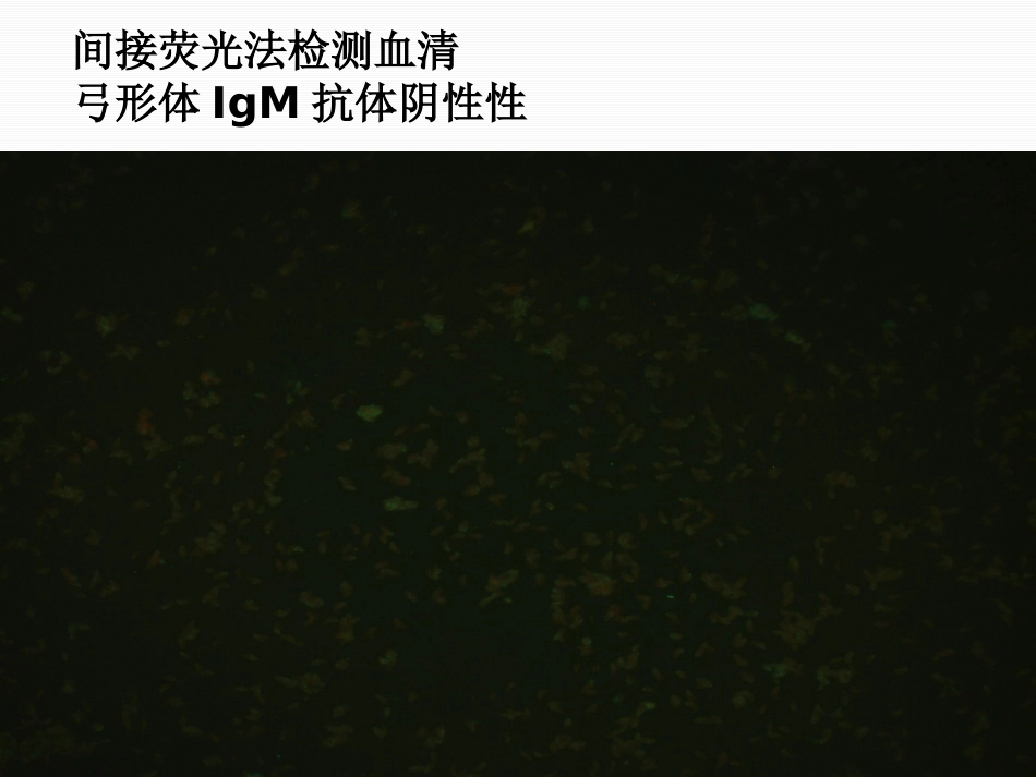 TORCH的检测及其临床意义_第15页
