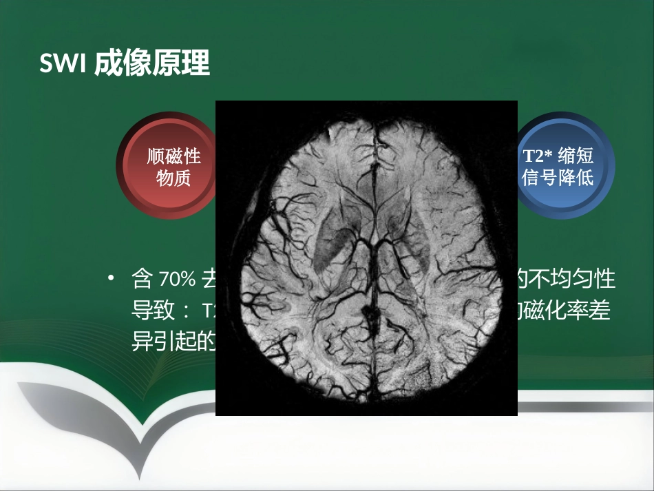 SWI的临床应用(1)_第6页
