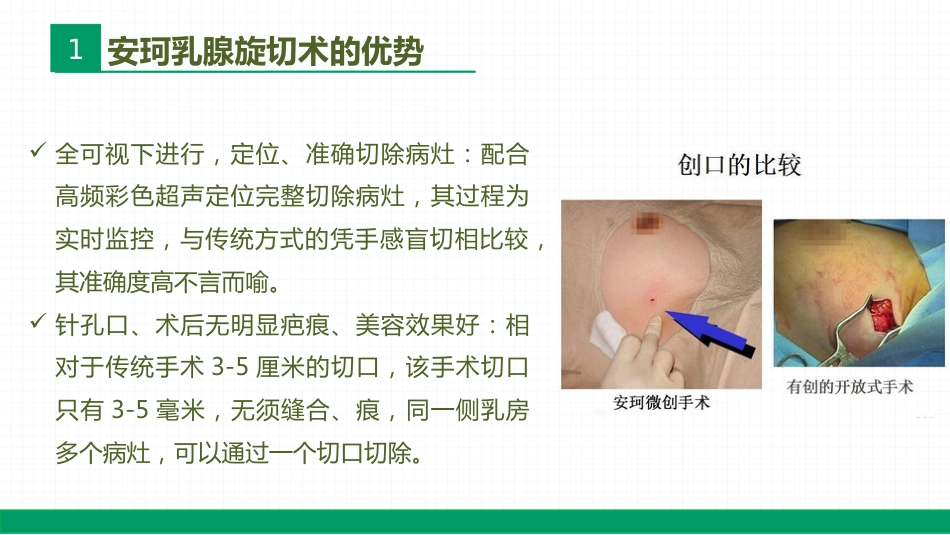 安珂乳腺旋切系统的临床应用(1)_第9页