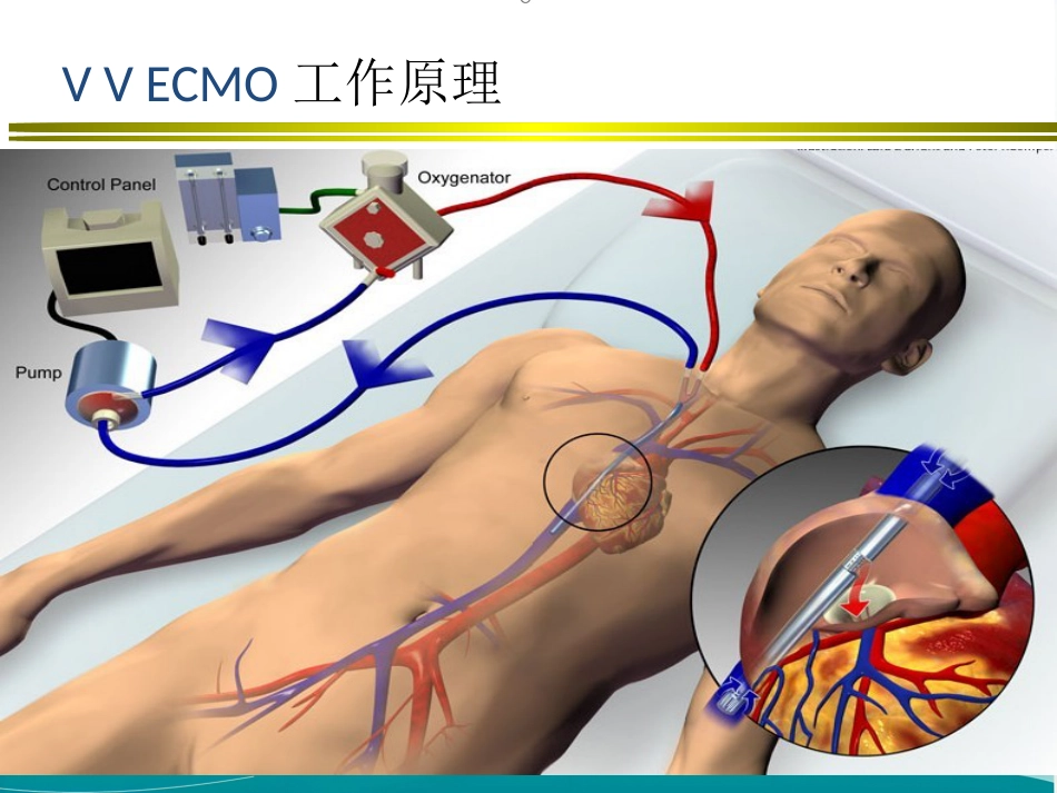 ECMO的临床应用(1)_第9页